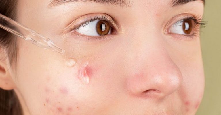 Inflammation - Woman Applying Facial Serum
